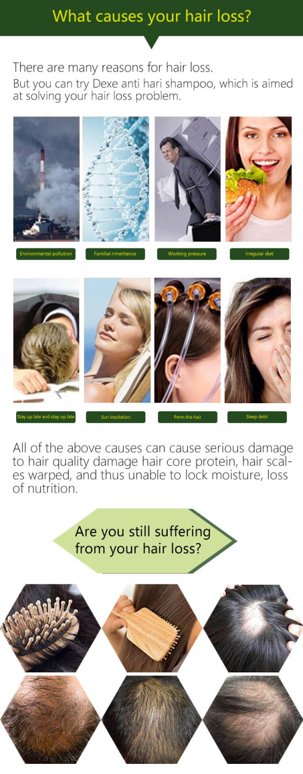 Dexe Anti-hair Loss Shampoo 200ml - Black Hair Shampoo | Hair Building