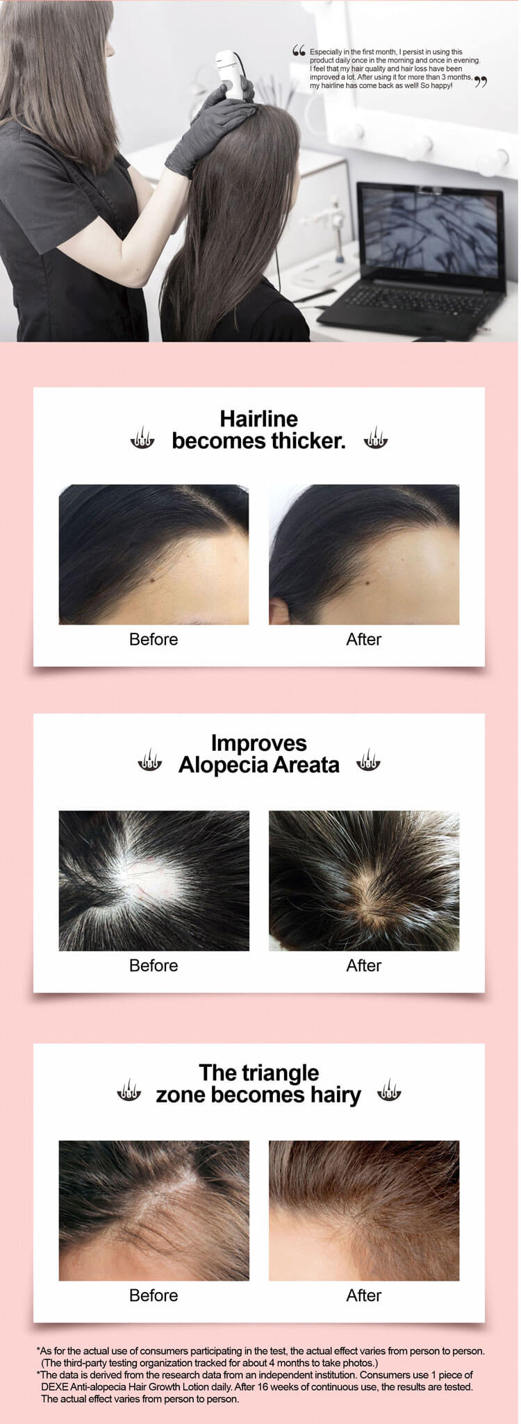Dexe Anti-hair Loss lotion 6ml*10 - Black Hair Shampoo | Hair Building  Fibers | Manufacturer | DEXE